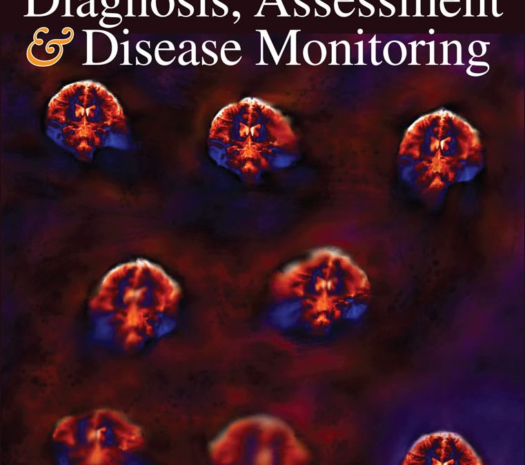 The association between multiple long-term conditions and dementia: A UK cohort study